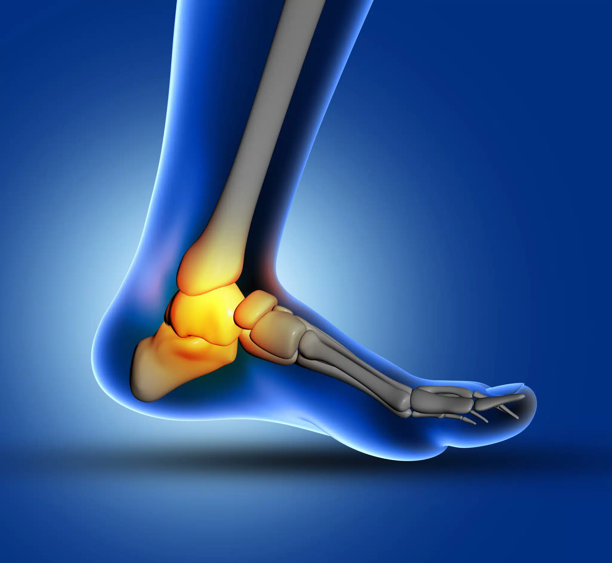 Stem Cell Therapy for Foot & Ankle Injuries