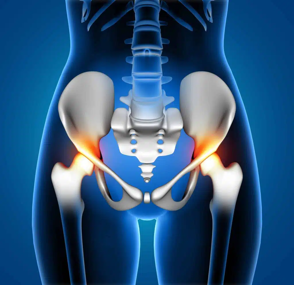 Stem-Cell-Therapy-for-Hip-Injuries-in-jupiter-florida