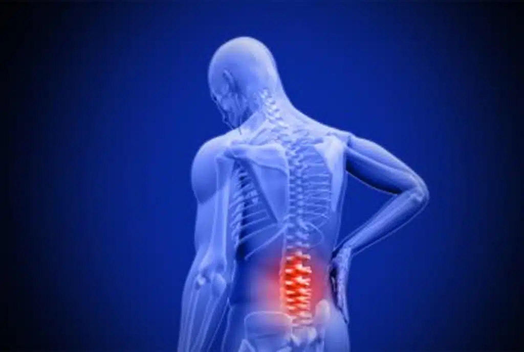 Back pain treatment florida backbone illustration