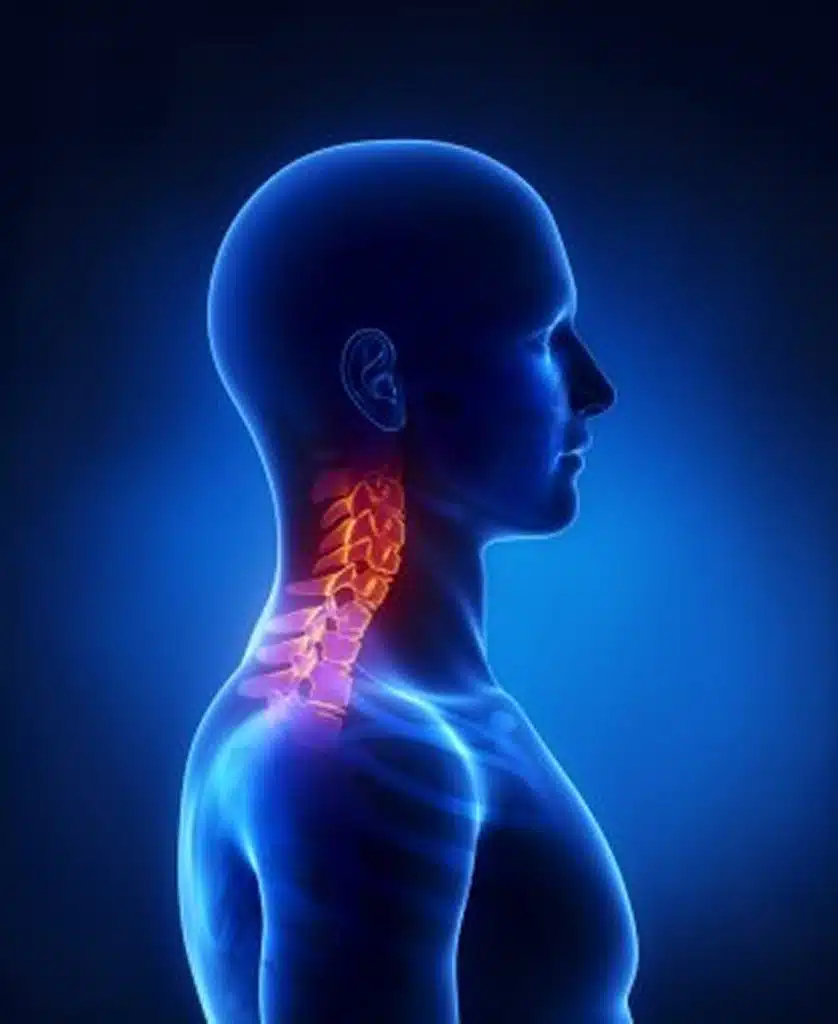 Neck pain management florida neck illustration