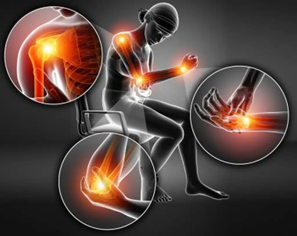 joint pain management florida body pain illustration