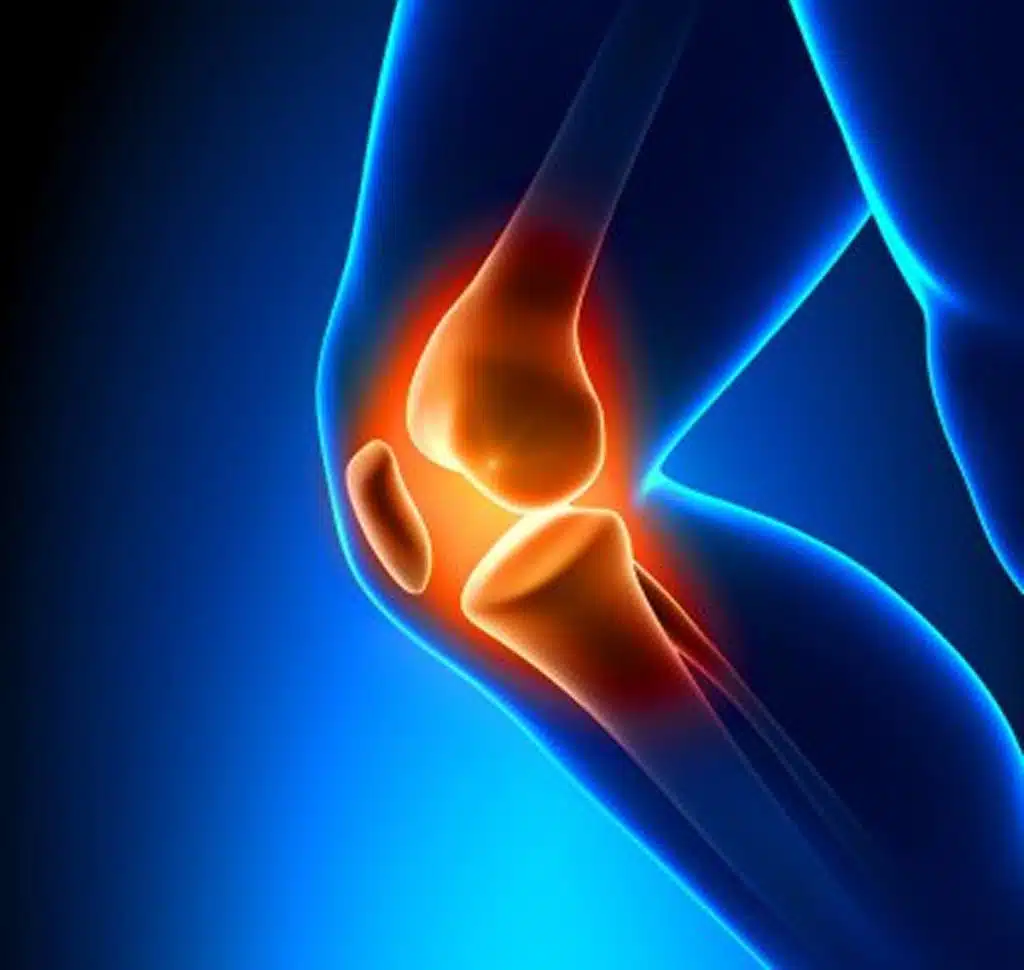 ligament injury care florida joint pain illustration