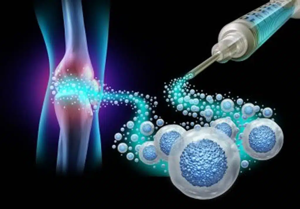 regenerative medicine for pain jupiter florida medicine mesenchymal stem cells