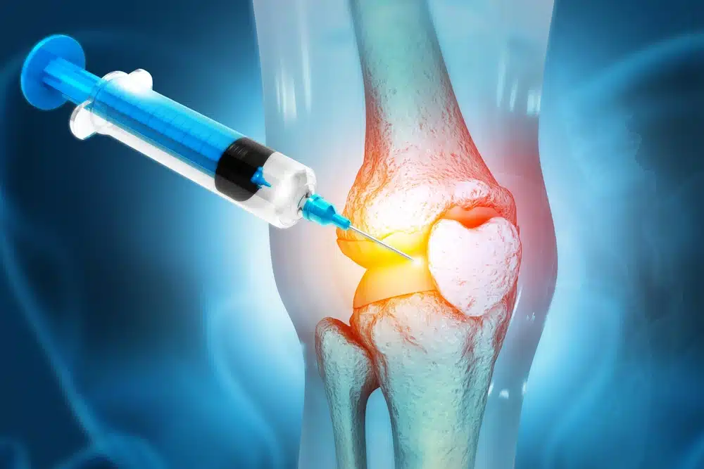 stem cell therapy for joint pain image