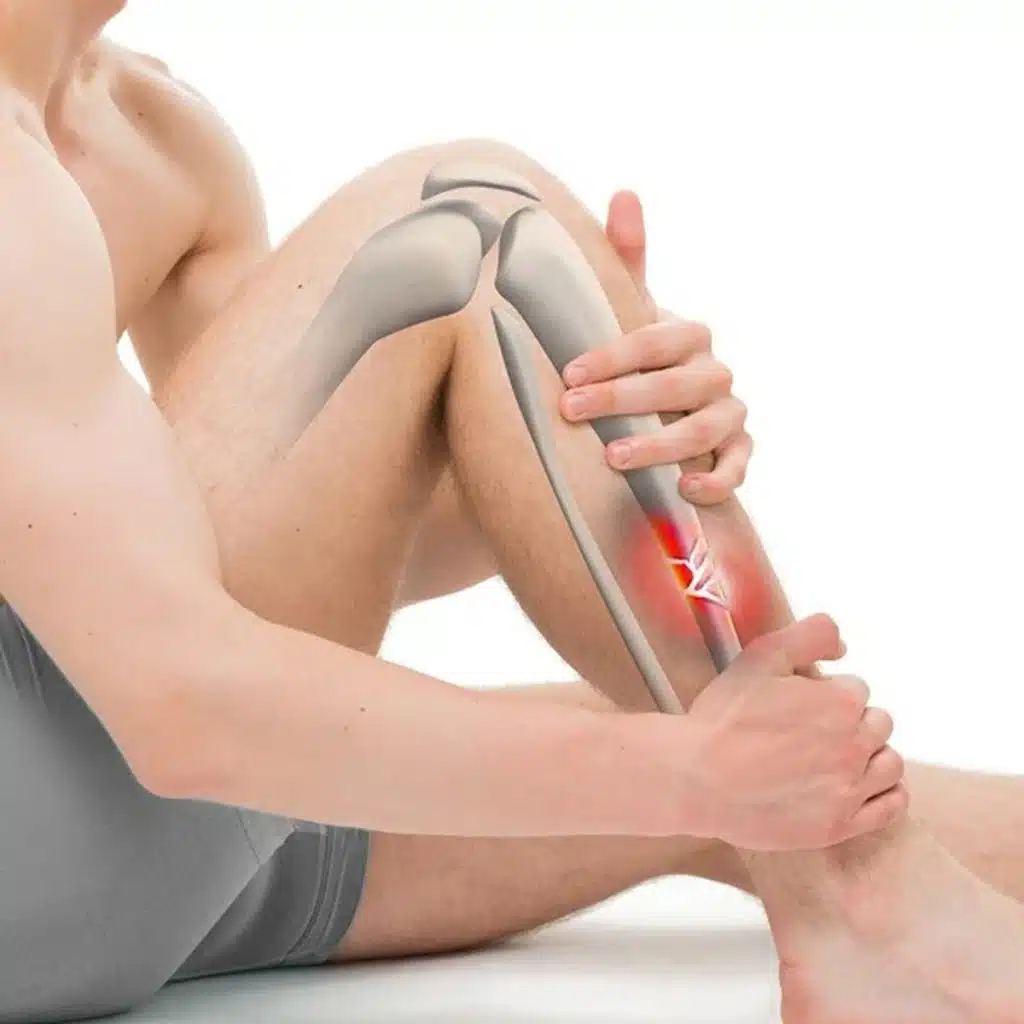 Advanced Focal Shockwave Therapy for tendon injuries jupiter florida image