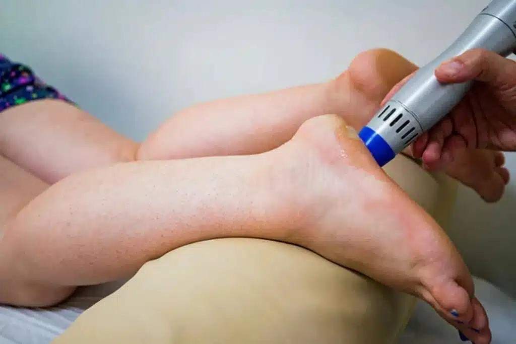 focal shockwave therapy tendon injuries in sebring florida using radial shockwave therapy machine