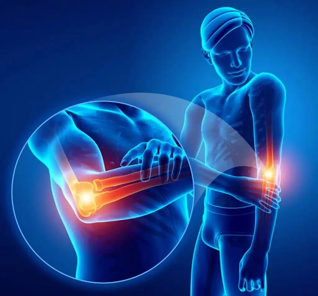 stem cell therapy for elbow pain wellington florida 3d illustration of male feeling pain in his elbow