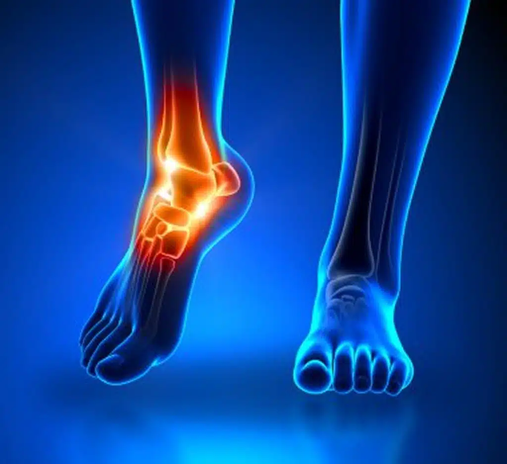 stem cell therapy for foot and ankle pain sebring florida photo ankle pain