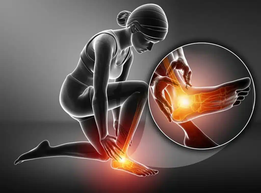 stem cell therapy for foot and ankle pain wellington florida 3d illustration of female foot