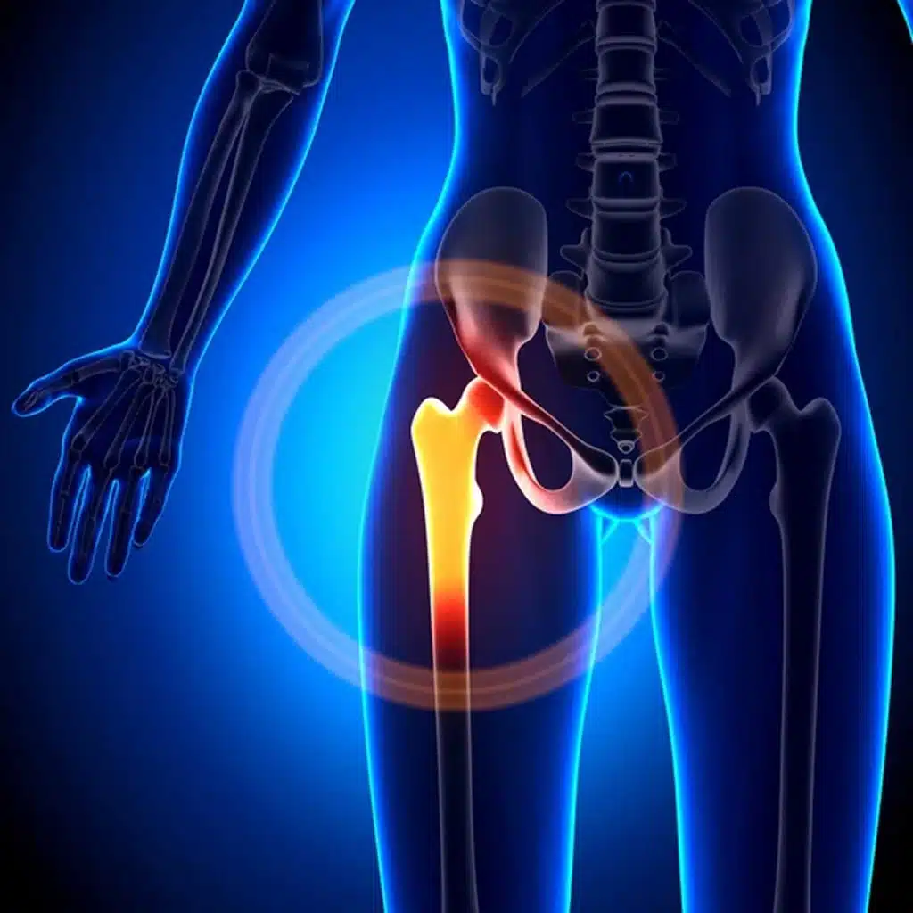 stem cell therapy for hip pain wellington florida female hip joint anatomy bones