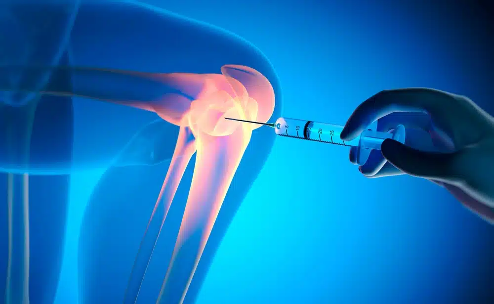 Human knee joint anatomy illustration for stem cell therapy for joints treatment