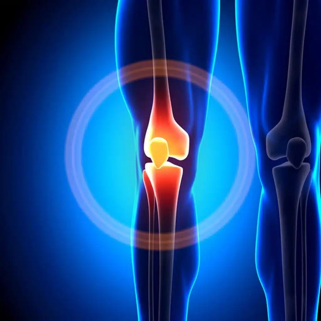 ligament injury care jupiter florida knee anatomy bones