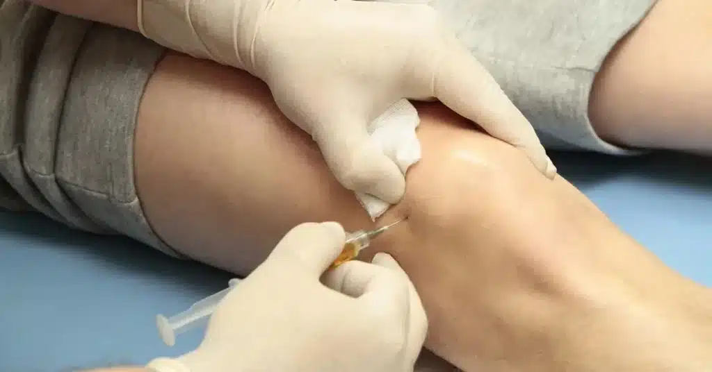prp therapy for pain in sebring florida image of knee injection 1
