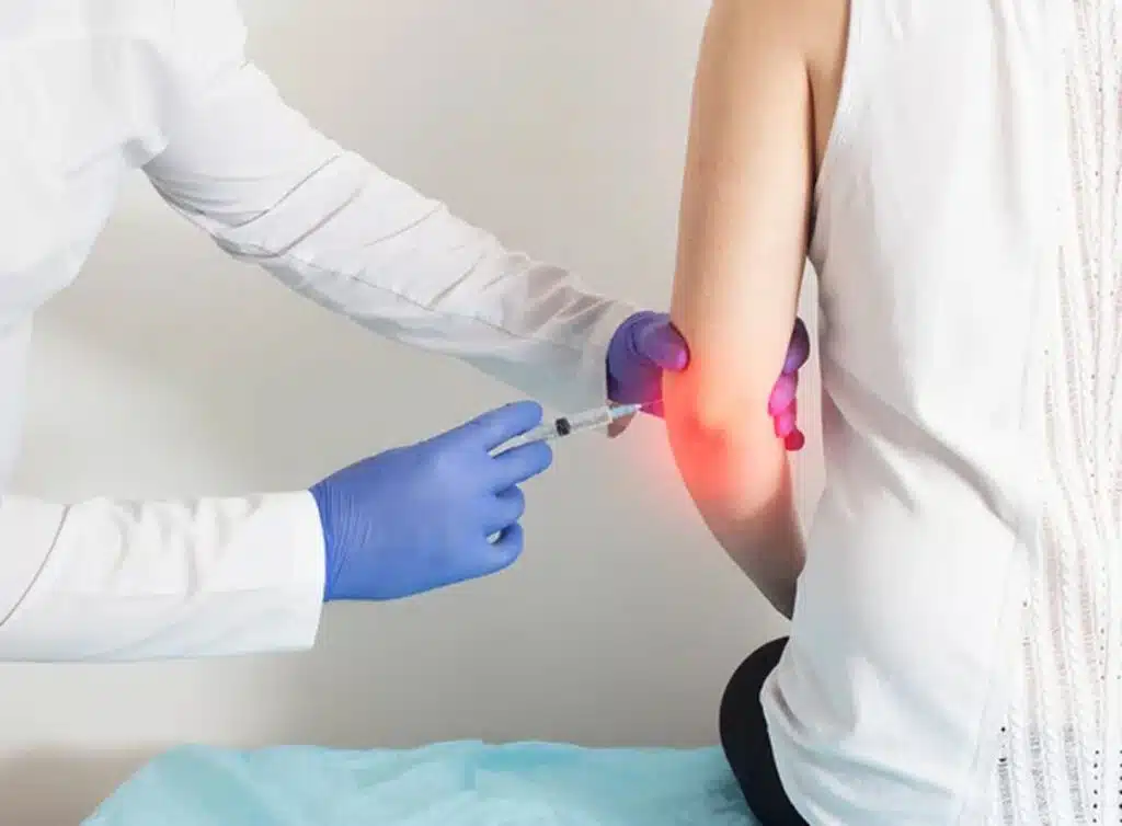 stem cell therapy for elbow pain in sebring fl photo