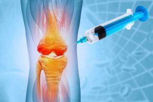 Platelet Rich Plasma Joint Injections Platelet Rich Plasma Joint Injections